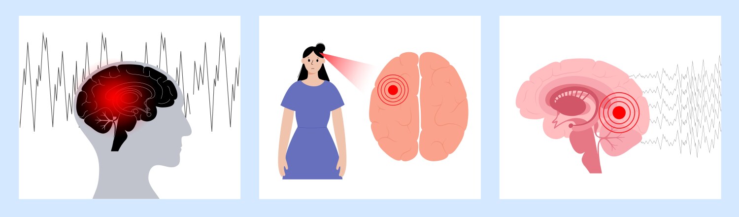 Epilepsy seizure concept Royalty Free Vector Image