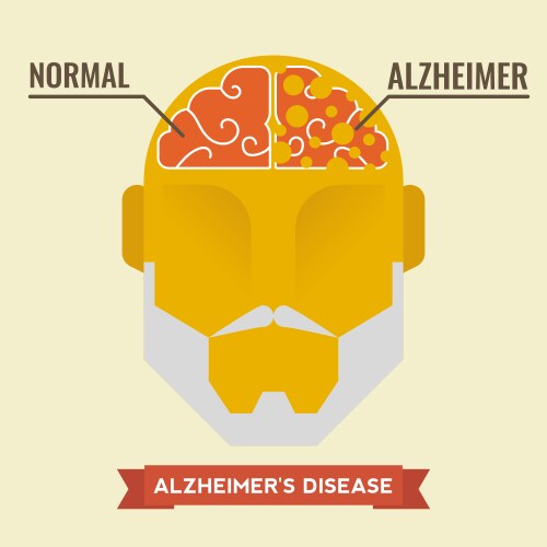Amnesia symptom alzheimer disease brain damage Vector Image