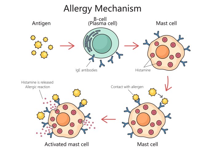 mechanism allergy action diagram medical science vector image