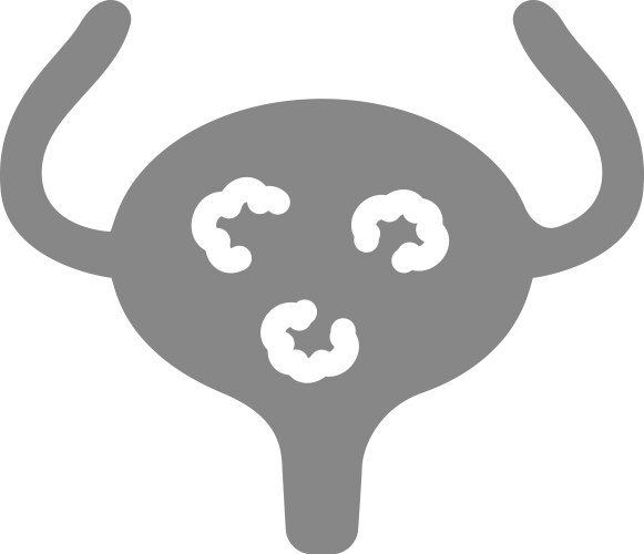 Human urinary bladder with tumors gray icon vector image