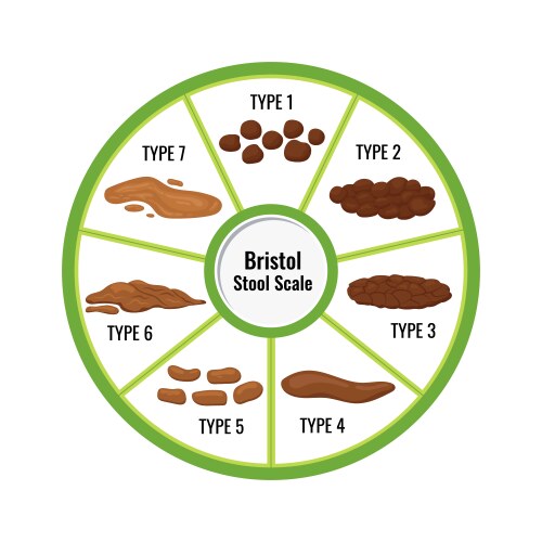 Bristol Stool Chart - Faeces Classification – Royalty-Free Vector ...