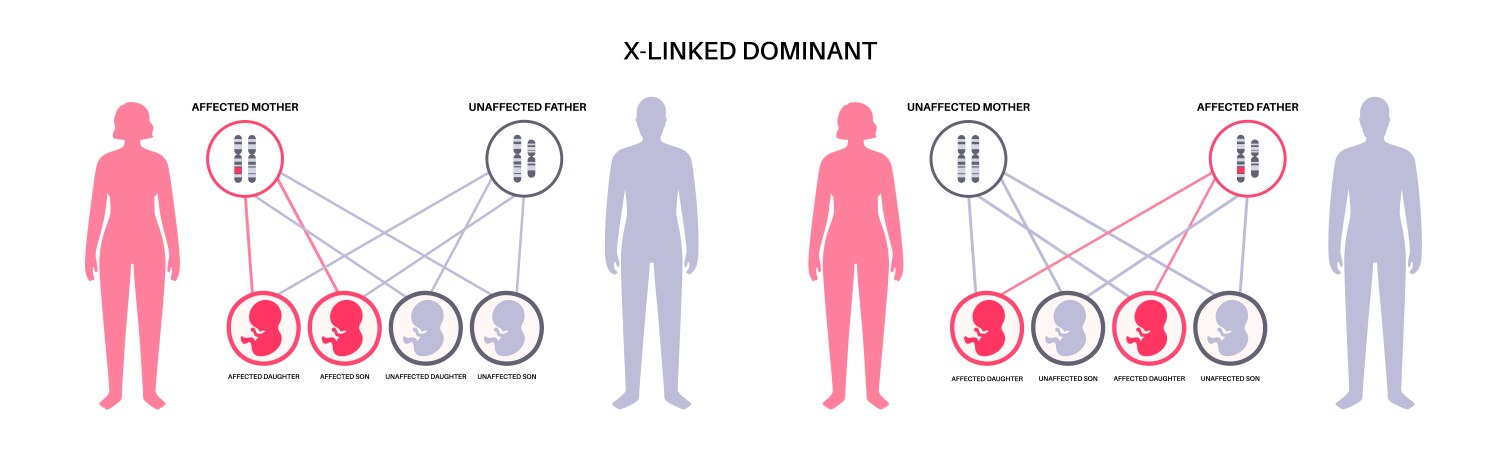 Dominant inheritance pattern vektorbild