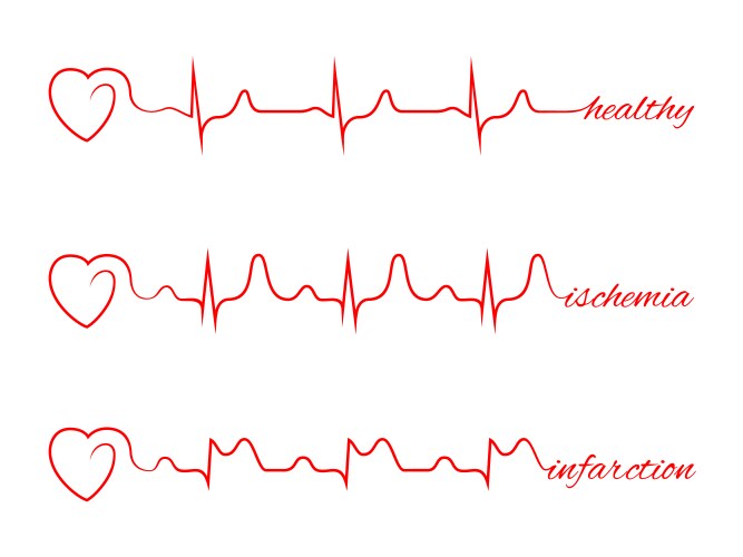 Heart beats various cardiogram set vector image