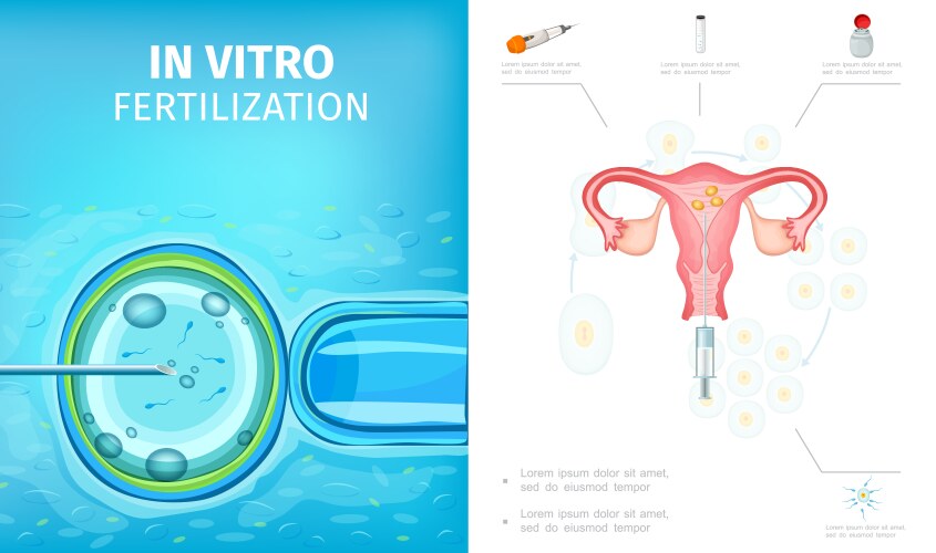 In vitro fertilization process concept Royalty Free Vector