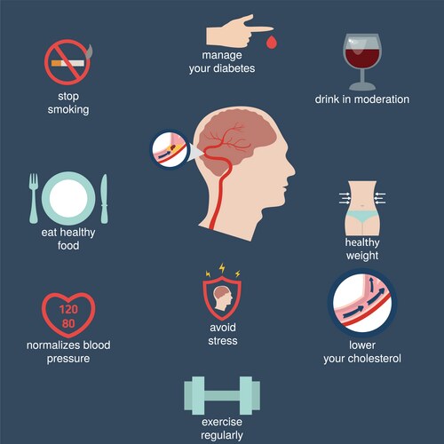 Stroke Risk Factors & Prevention – Royalty-Free Vector | VectorStock