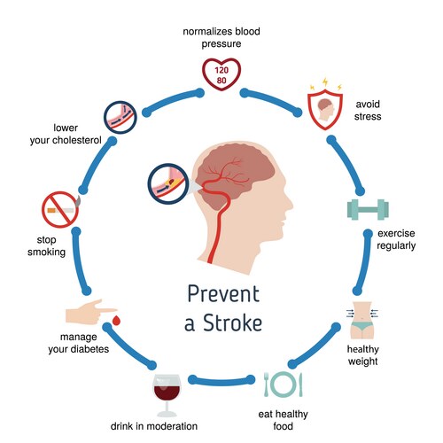 Stroke Risk Factors & Prevention – Royalty-Free Vector | VectorStock