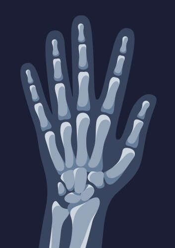 x ray image of human hand medical roentgen vector image