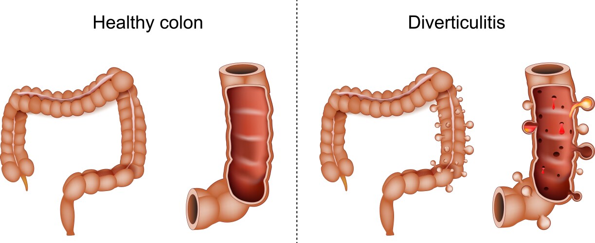 Difference Vector Images (over 300,000)