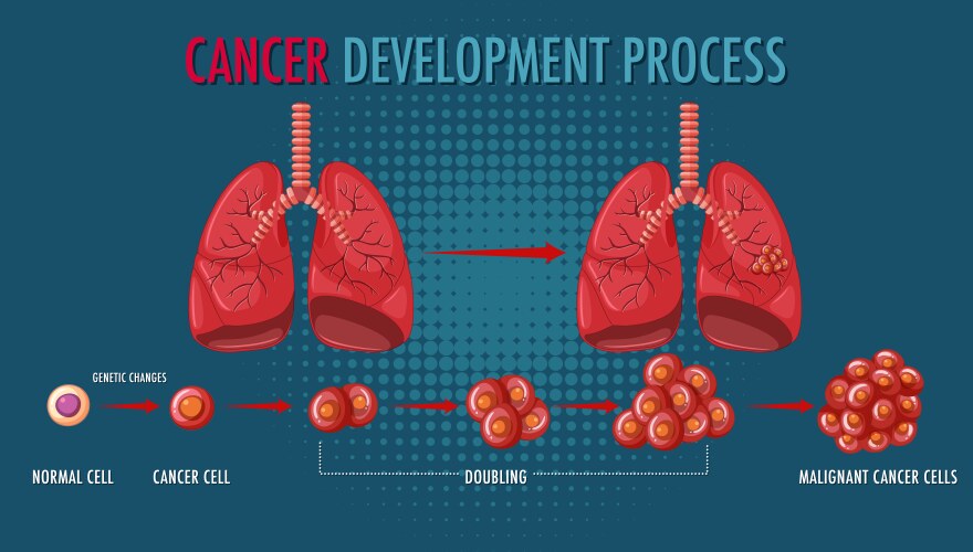 Process of cancer development infographic Vector Image