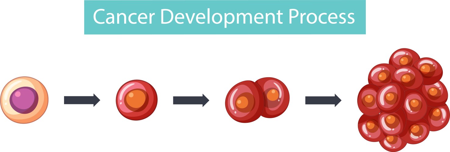 Process of cancer development infographic Vector Image