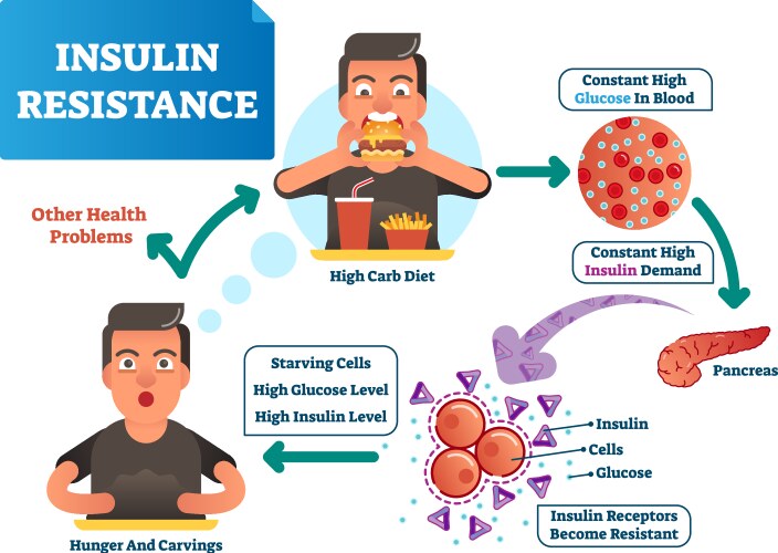 insulin resistance labeled vector image