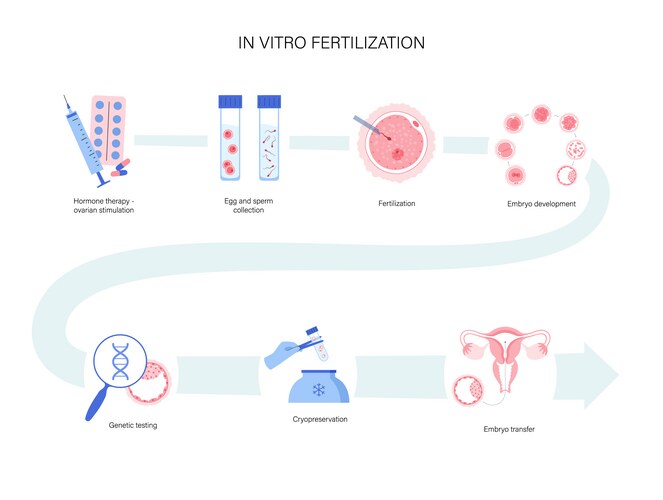 In Vitro Fertilization Process – Royalty-Free Vector | VectorStock