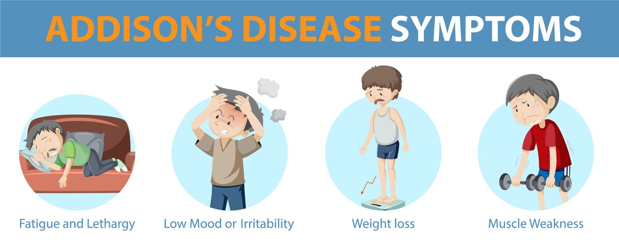 Addison's Disease Symptoms - Medical Infographic – Royalty-Free Vector ...
