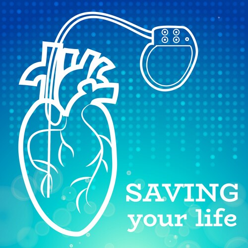 Pacemaker Coloring Heart Pacemaker Medical Wallpaper – Royalty-Free Vector | VectorStock