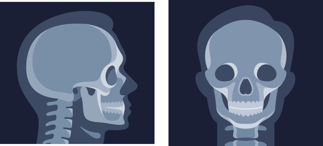 Human head x ray image skull front side view vector image