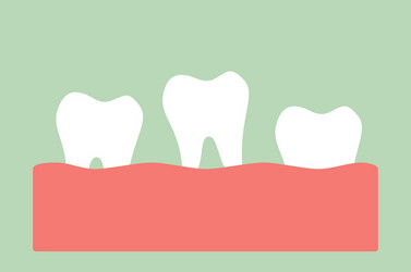 Cartoon Missing Tooth Vector Images (over 120) Cartoon Missing Tooth Vector Images (over 120)