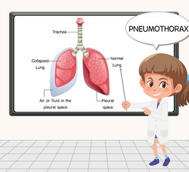 young scientist explain pneumothorax in front vector