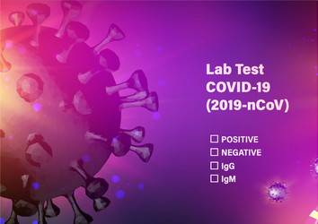 lab test check list on covid-19 computer model vector image