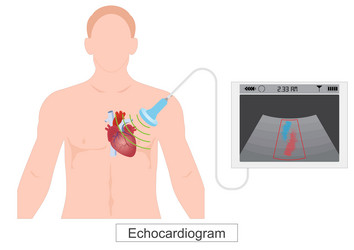 an echocardiogram echo is a test that diagnoses vector image