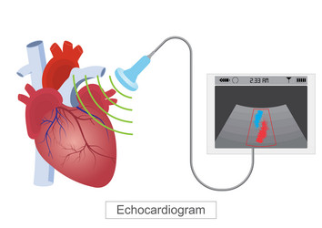 an echocardiogram echo is a test that use high vector image