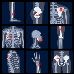 Skeleton x ray vector