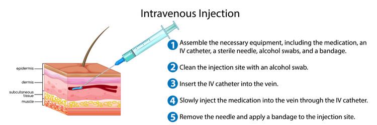 intravenous injection with explanation vector