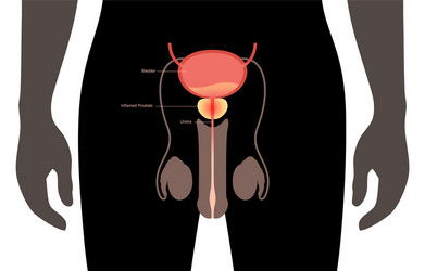 Prostatitis inflammation problem vector