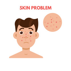 Men skin problem facial care vector