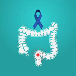 Bowel cancer color glyph icon. Oncology. Isolated vector element. Pictogram  for web page, mobile app, promo Stock Vector Image & Art - Alamy