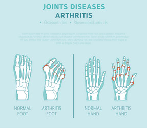 Joints diseases arthritis symptoms treatment icon vector