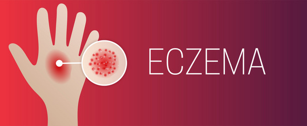Red eczema background design Royalty Free Vector Image