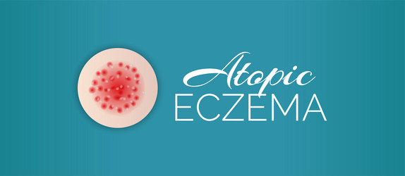 Red eczema background design Royalty Free Vector Image