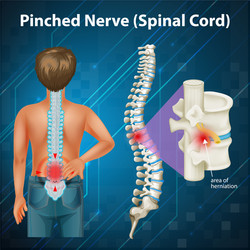 Diagram showing spinal cord vector