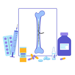 Structure a long bone humerus tube Royalty Free Vector Image