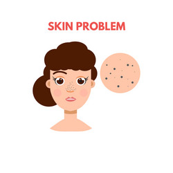 Woman with skin problem vector