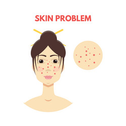 Woman with skin problem vector