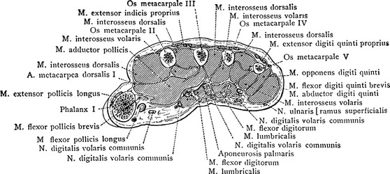 cross section through middle metacarpal bones vector image