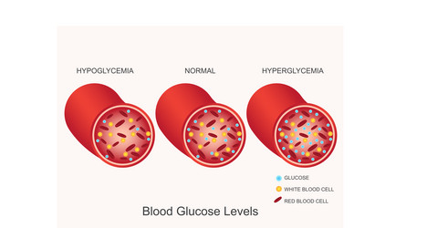 Blood glucose measurement and levels Royalty Free Vector