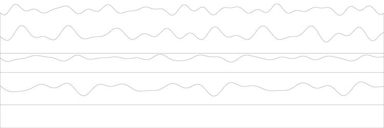 complex brainwave activity displayed in eeg graph vector image
