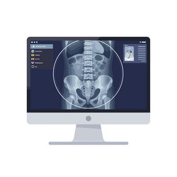 digital of an x-ray display on a computer monitor vector image