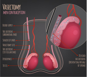 Man vasectomy image vector