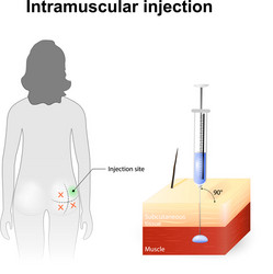 Injection sites in buttock Royalty Free Vector Image