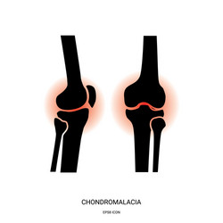 bursitis and knee joint icon vector