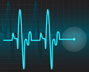 Ecg tracing Royalty Free Vector Image - VectorStock