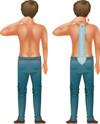 back man with spinal nerve problem vector