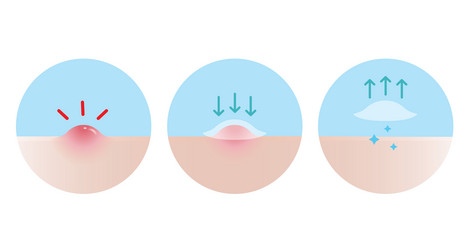 Acne Pimple Patch Usage Guide vector image