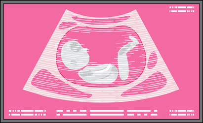 ultrasound picture of fetus vector