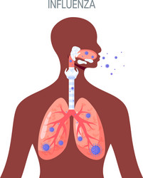 Influenza Vector Images (over 72 000)