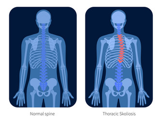 skeleton x ray vector