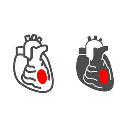 Myocardial Ischemia Vector Images (73)